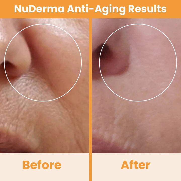 NuDerma Standard Complete High Frequency Bundle – Anti-Aging